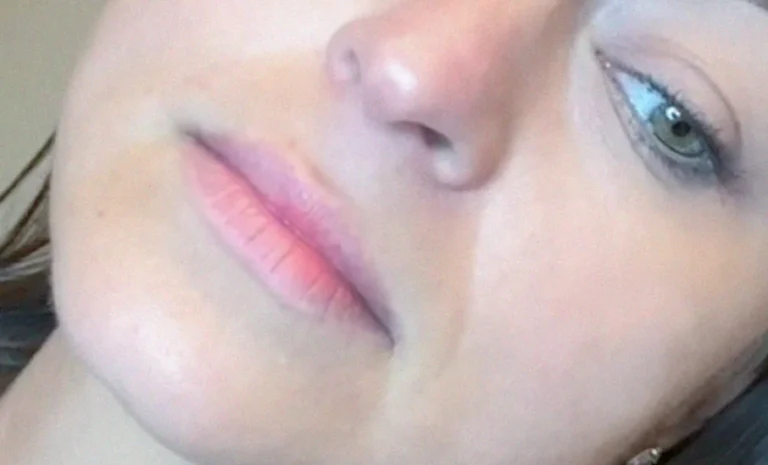Lip-Blushing-Slider-before